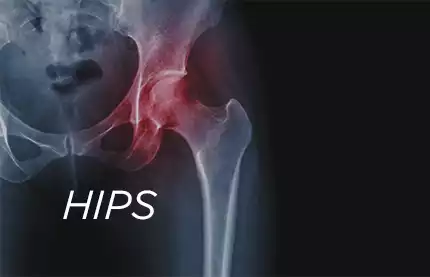 Image Orthopaedics Hips Service